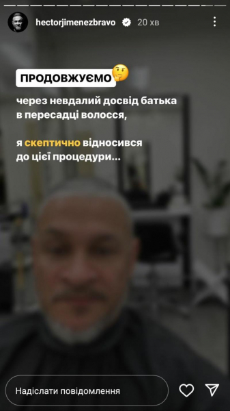 Щоб не облисіти, як батько: Ектор Хіменес-Браво зважився на операцію з пересадки волосся