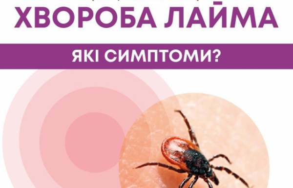Хвороба Лайма — як вберегтися: Поради закарпатських лікарів Хвороба Лайма — як вберегтися: Поради закарпатських лікарів