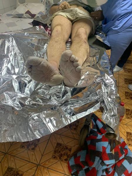  На Закарпатті у горах прикордонники виявили без свідомості чоловіка з обмороженими кінцівками 